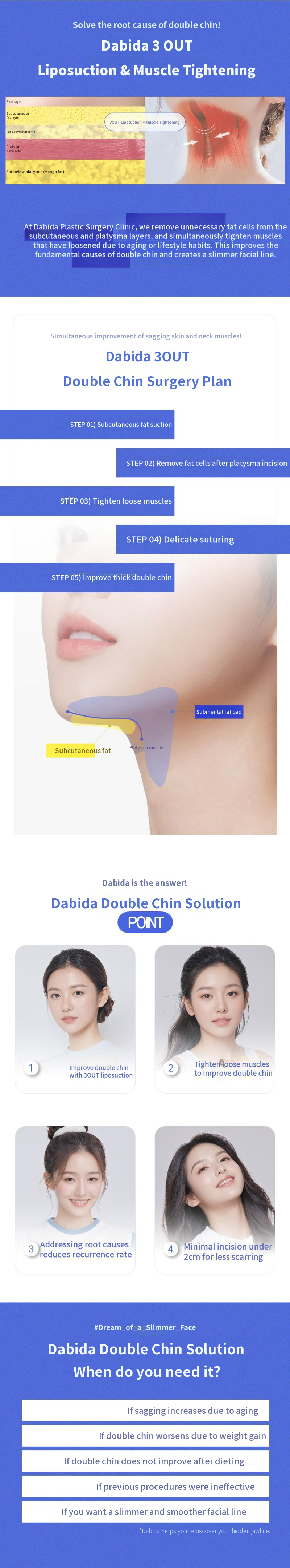 Davida Double Chin Eraser Liposuction & Muscle Stitching