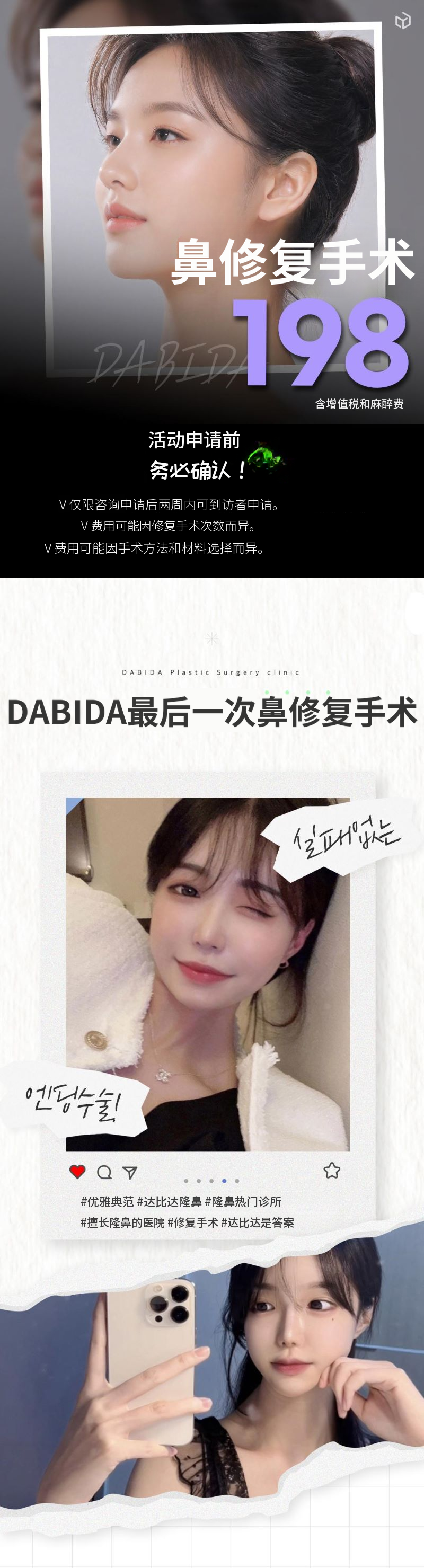 达美达最后一次鼻修复手术