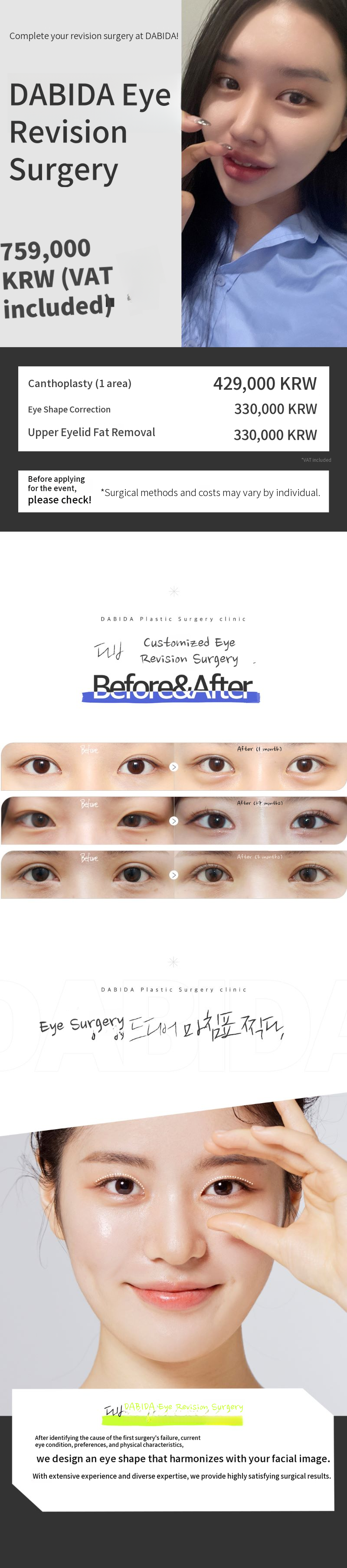 Final Touch on Double Eyelid Revision Surgery