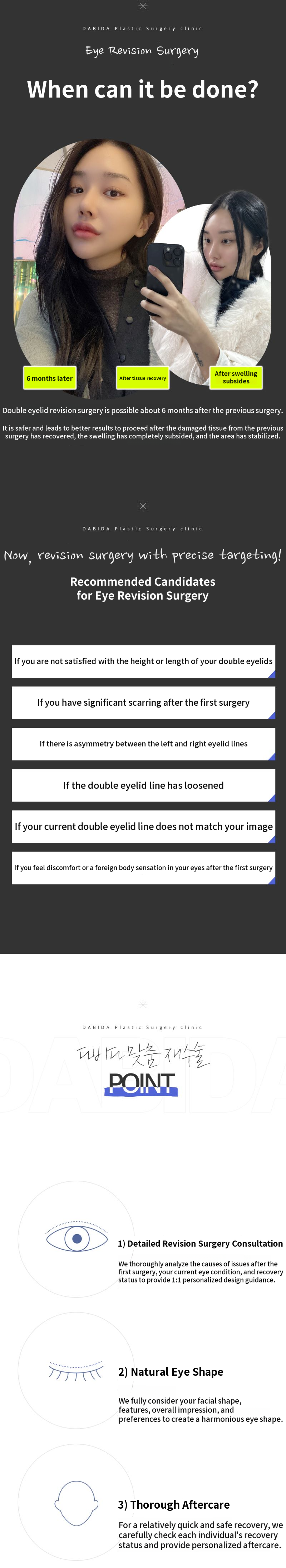 Final Touch on Double Eyelid Revision Surgery