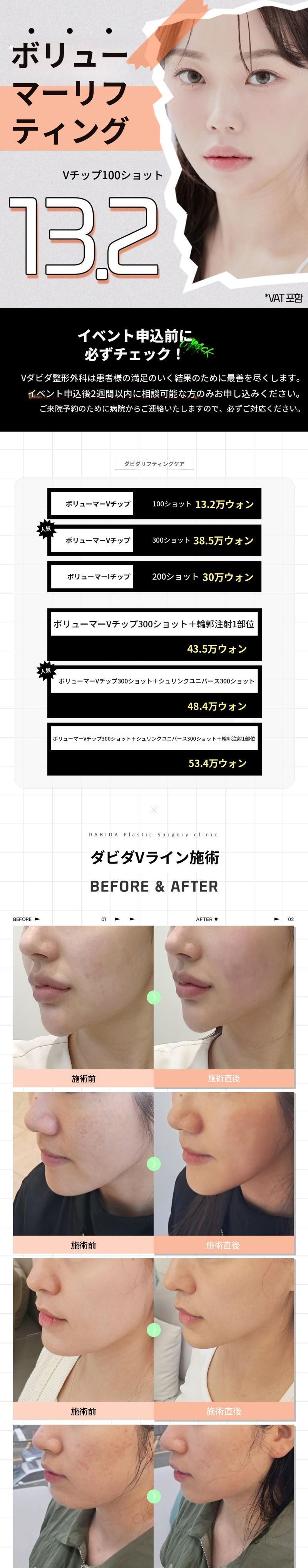 弾力のあるしっかりしたボリュームリフティング