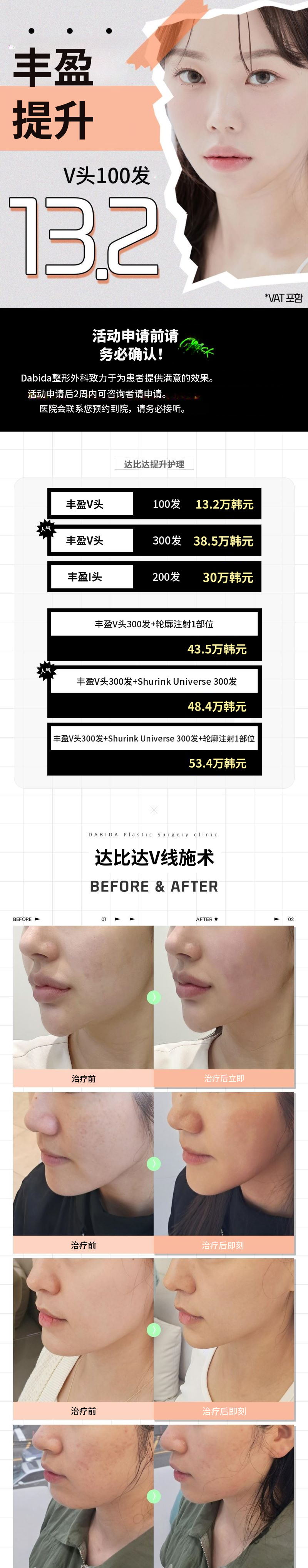弹性紧致面颊提升