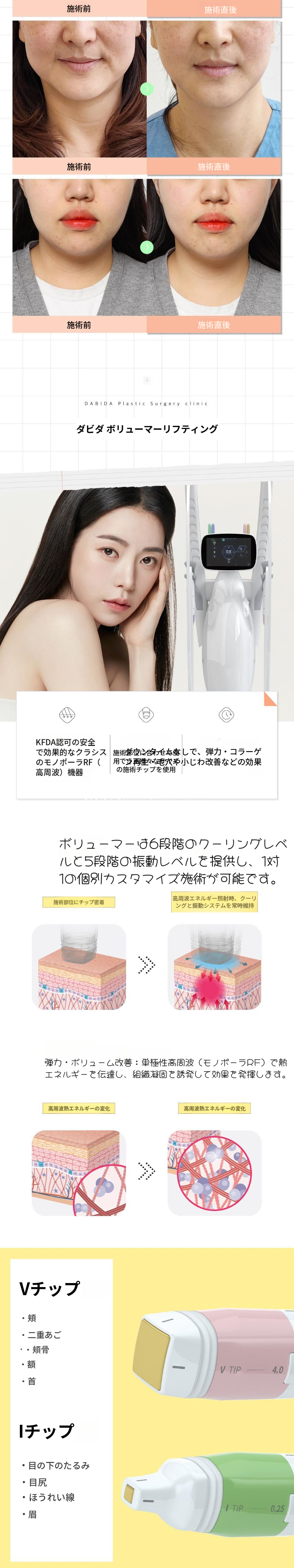 弾力のあるしっかりしたボリュームリフティング