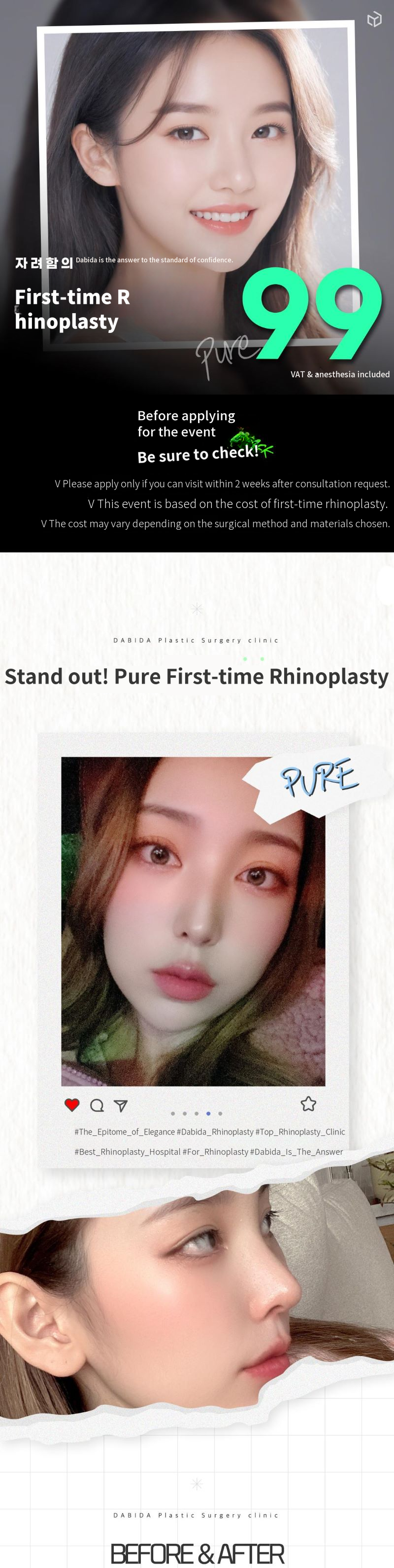 Davida Pure First Nose Surgery