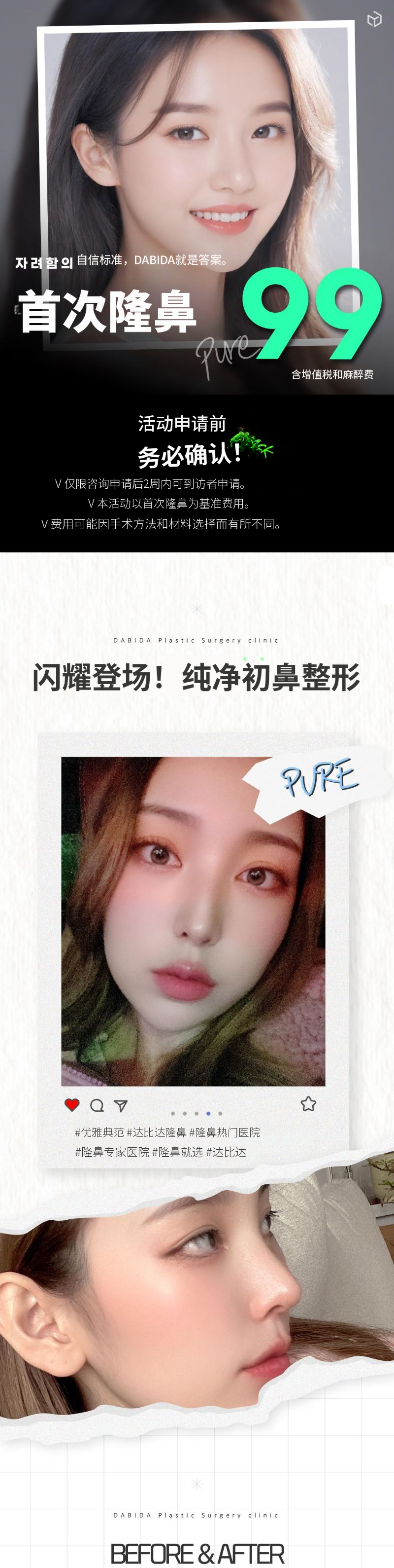 达美达纯第一鼻整形