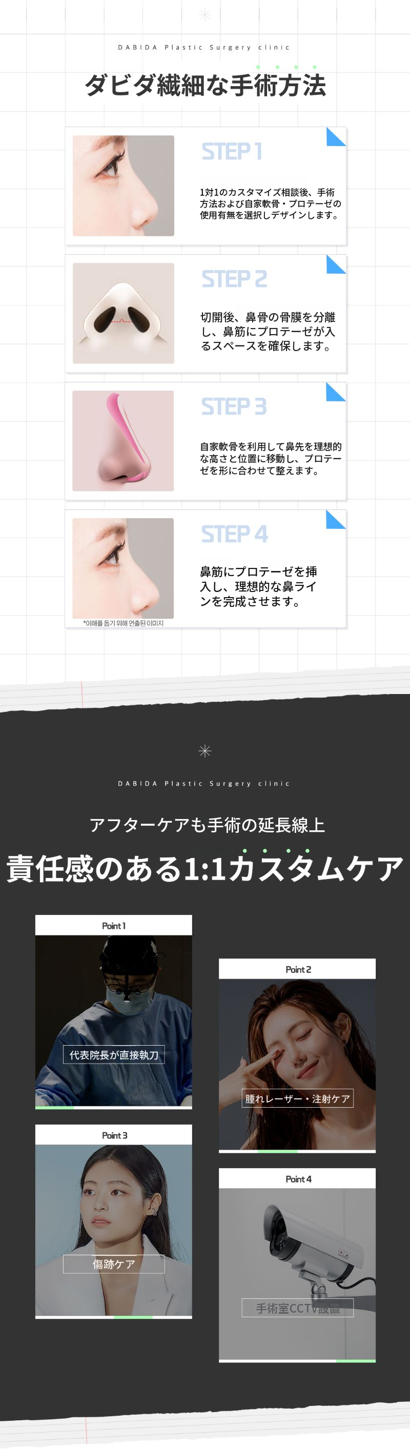 ダビダピュア初鼻整形