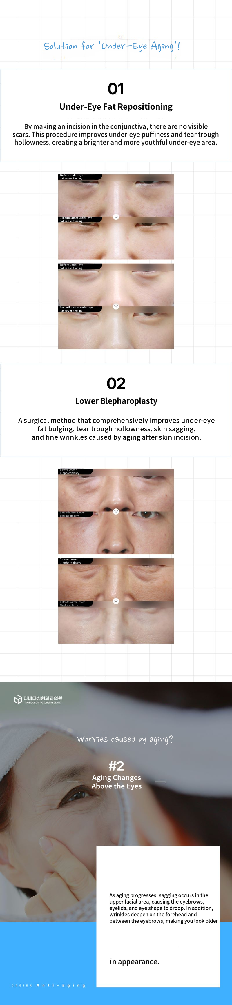 Turning Back Time: Middle-Aged Cosmetic Surgery