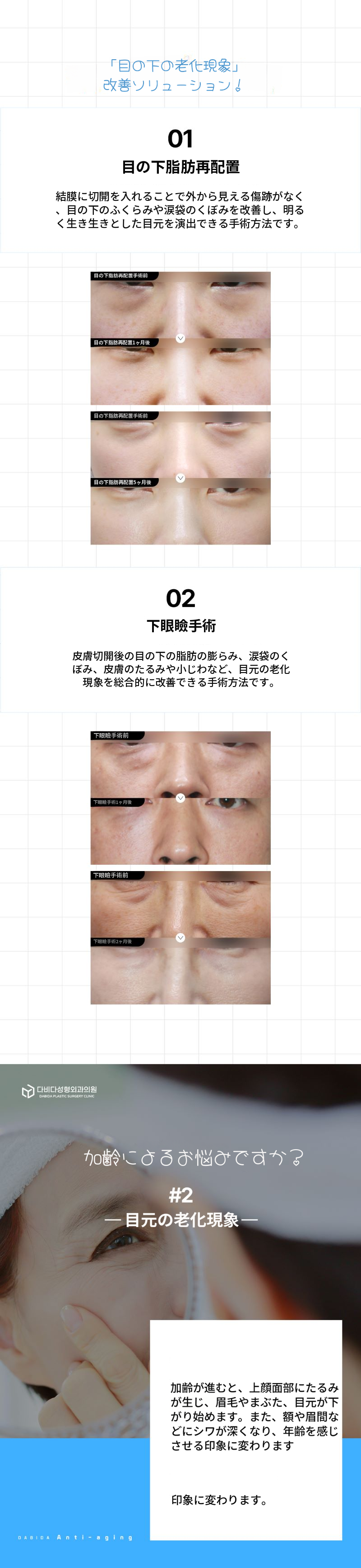 時間を戻す中年整形