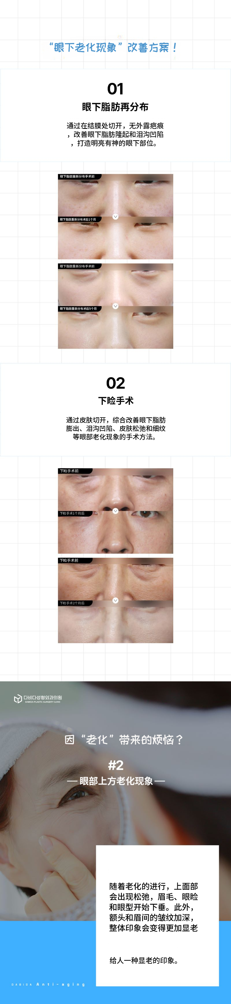 逆转时光的中年整形
