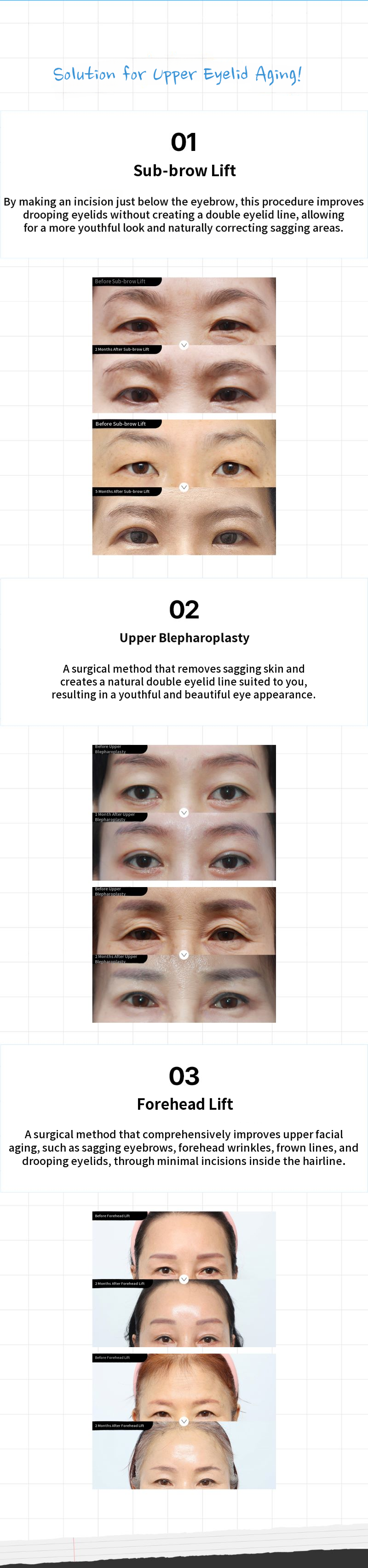 Turning Back Time: Middle-Aged Cosmetic Surgery