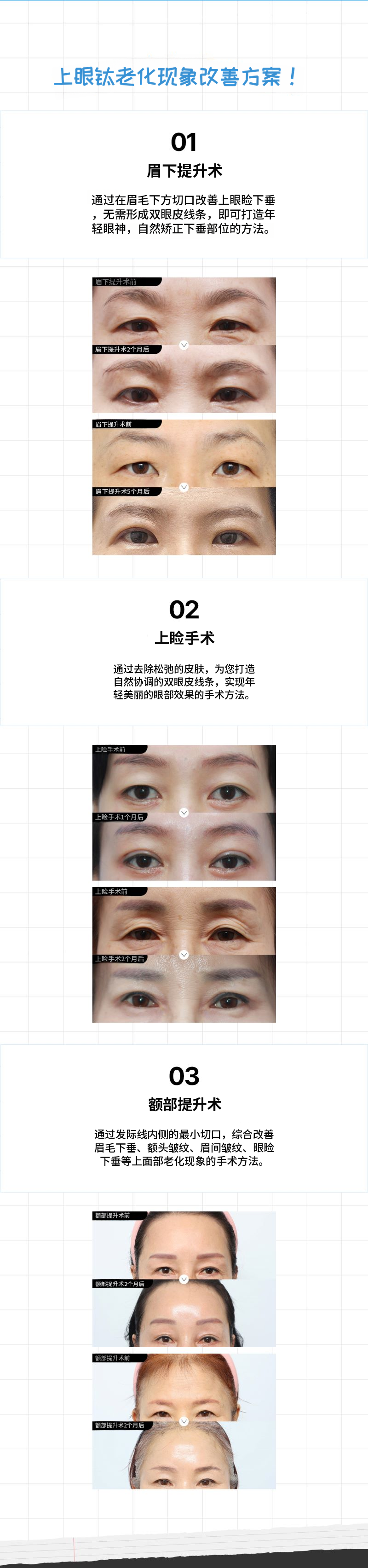 逆转时光的中年整形