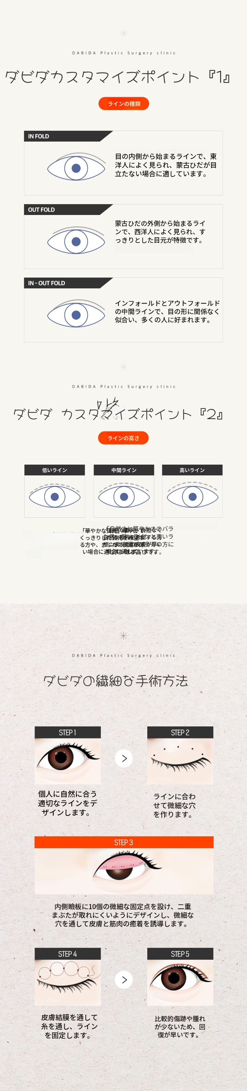 ダビダ自然癒着二重まぶた