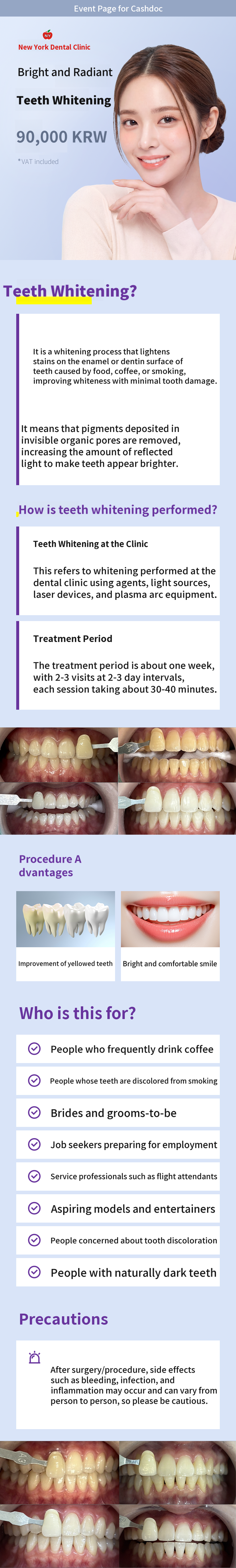 Bright and Radiant Teeth Whitening