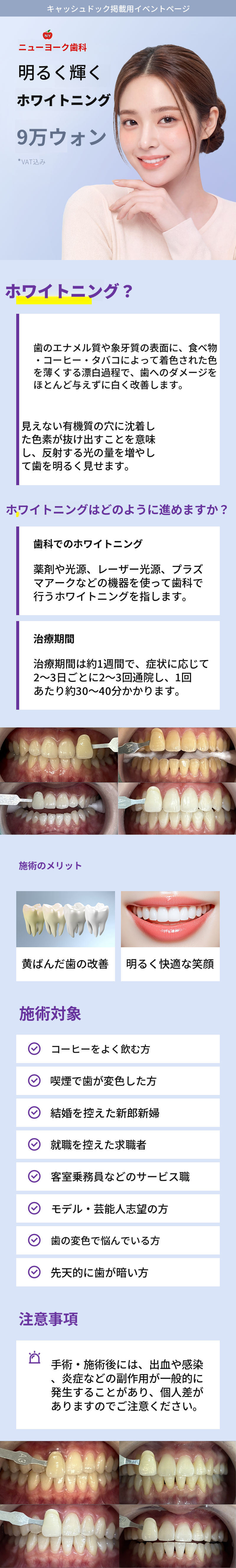 明るく輝くホワイトニング