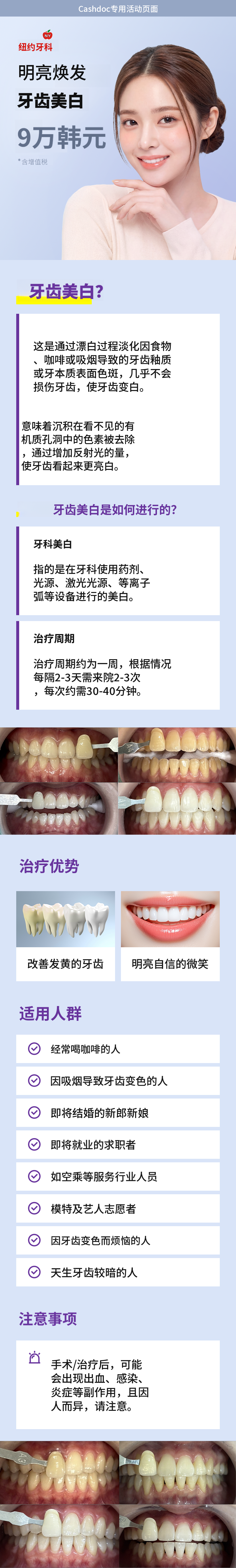 明亮洁白的牙齿美白