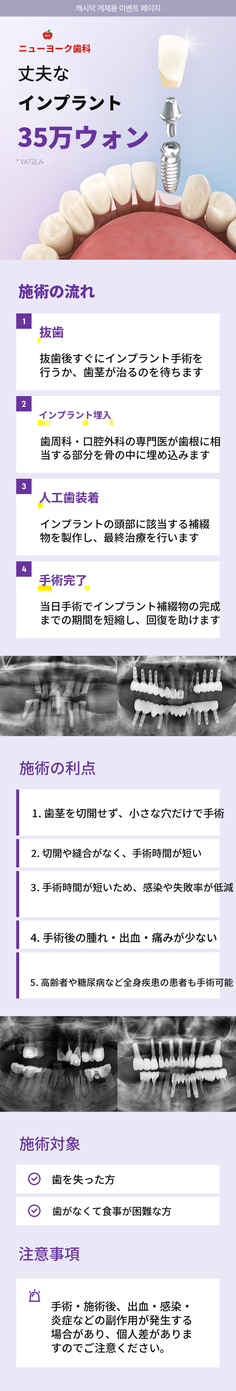 強固なインプラント