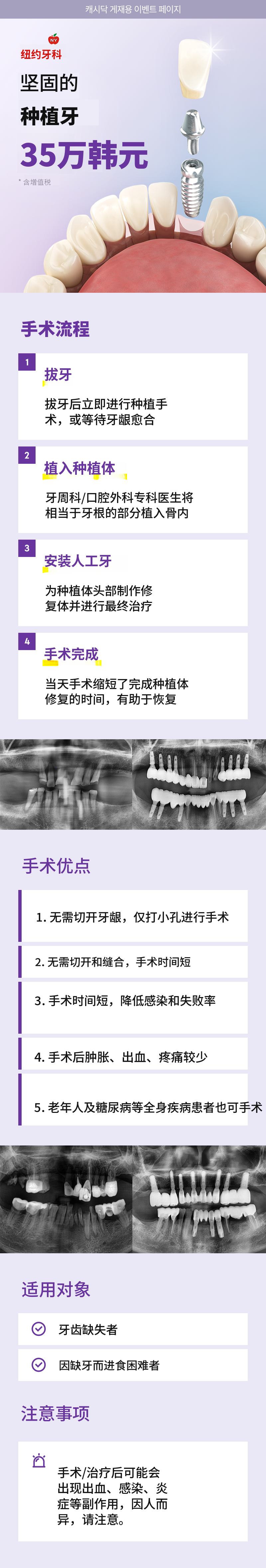 坚固的植牙