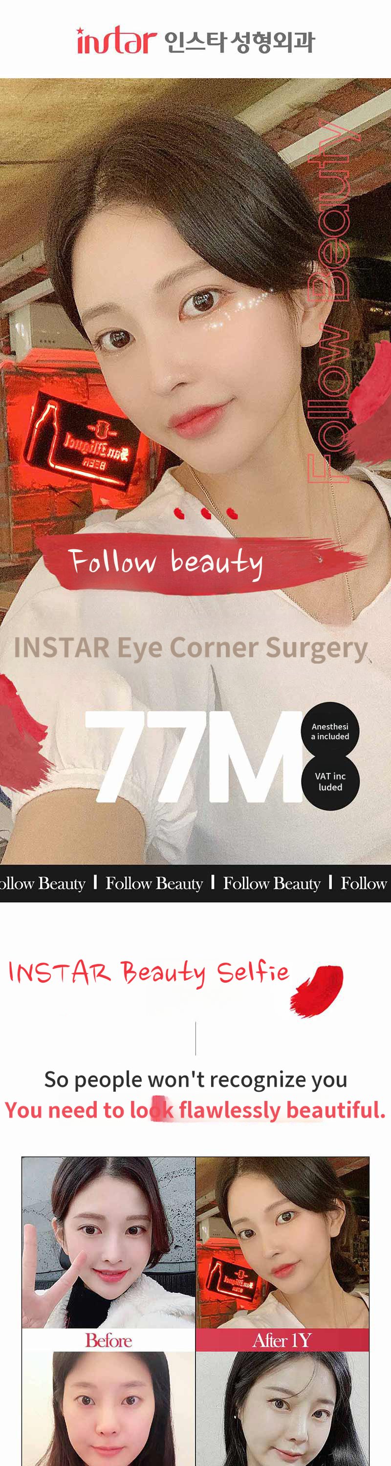 ❣️ Instagram ❣️ Perfect Eyelid Filler ❣️