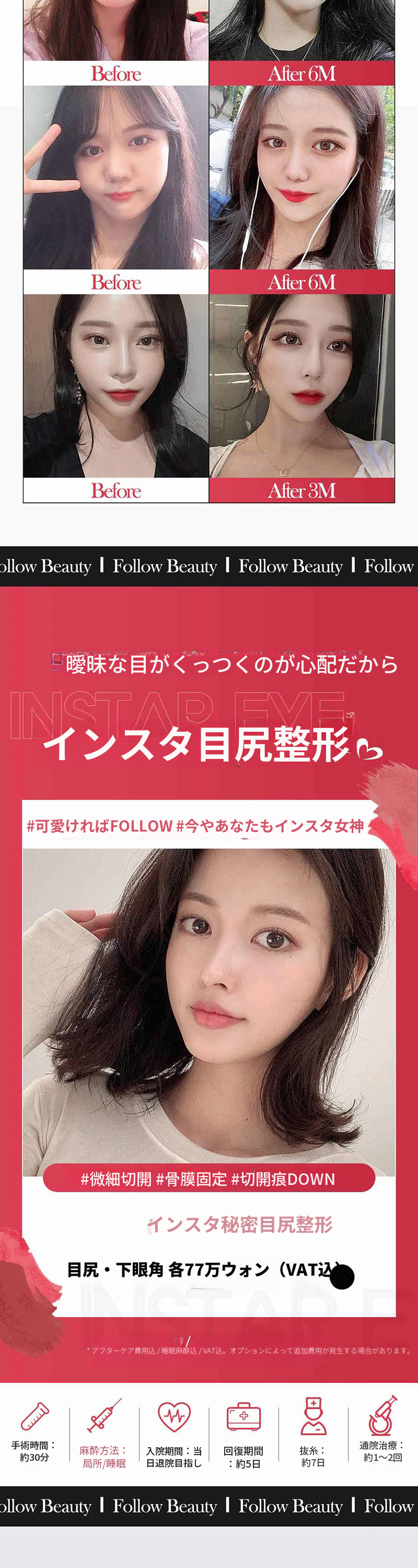 ❣️インスタ❣️感覚トリミング❣️
