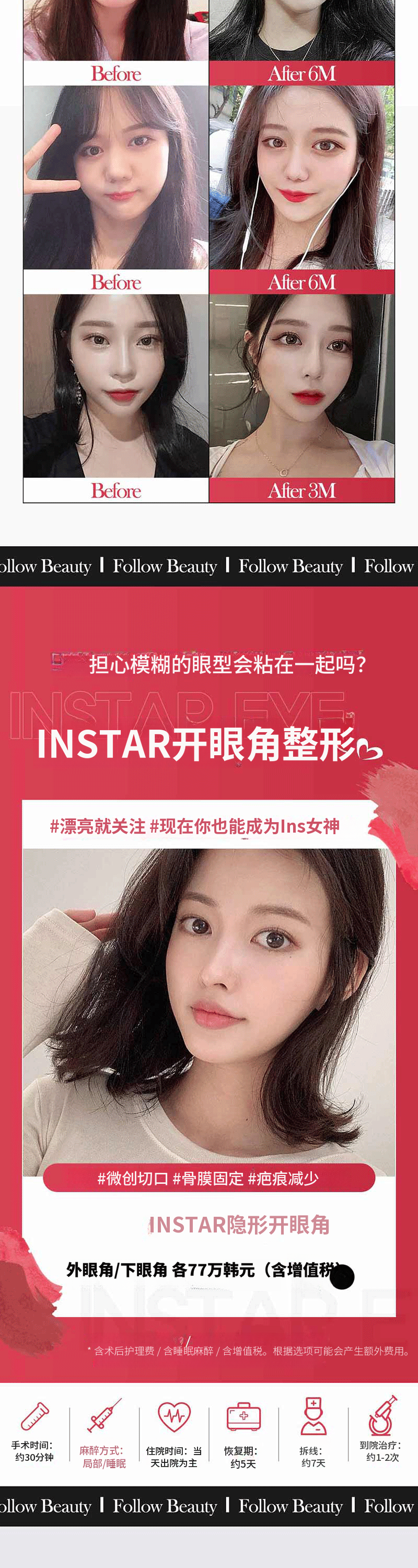 ❣️ Instagram ❣️ 完美眼睑❣️