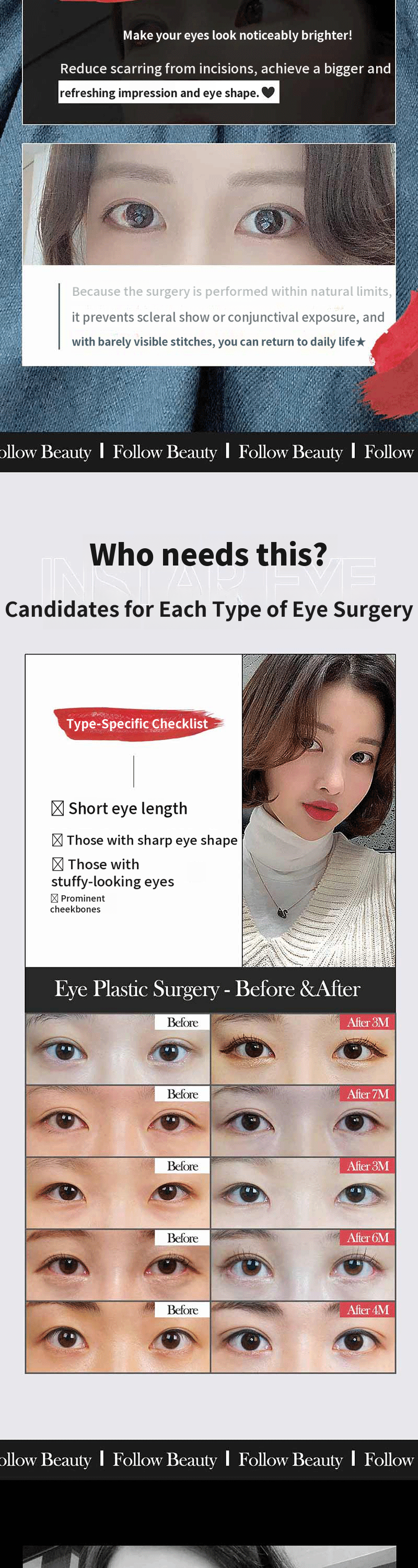 ❣️ Instagram ❣️ Perfect Eyelid Filler ❣️
