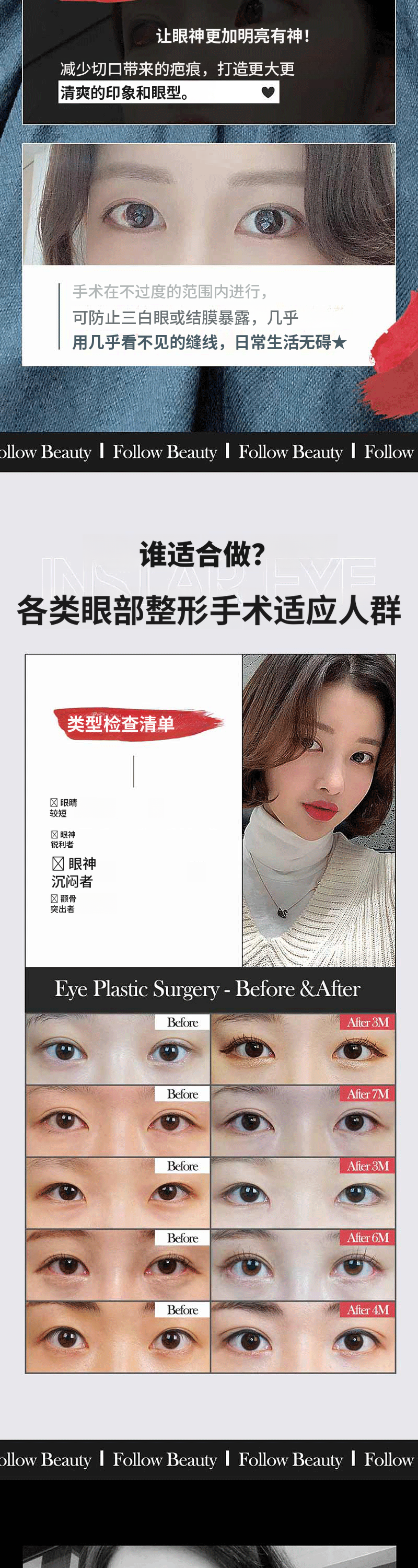 ❣️ Instagram ❣️ 完美眼睑❣️
