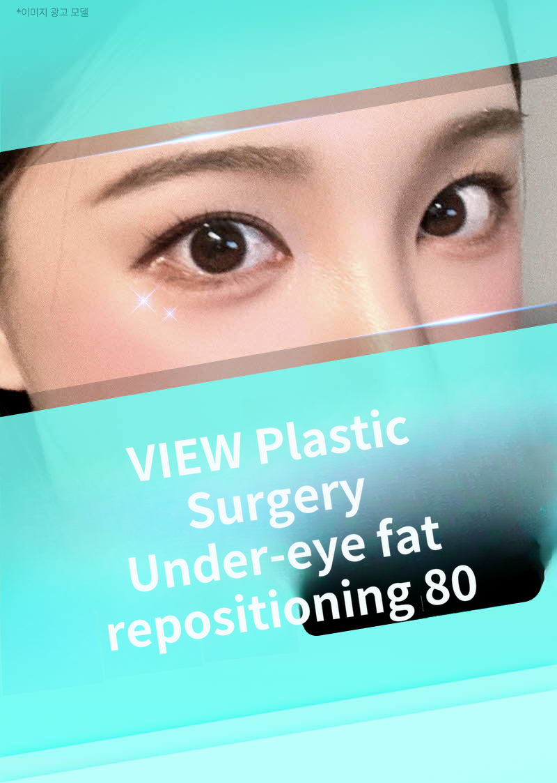 ❤️View❤️Lower Eyelid Fat Repositioning