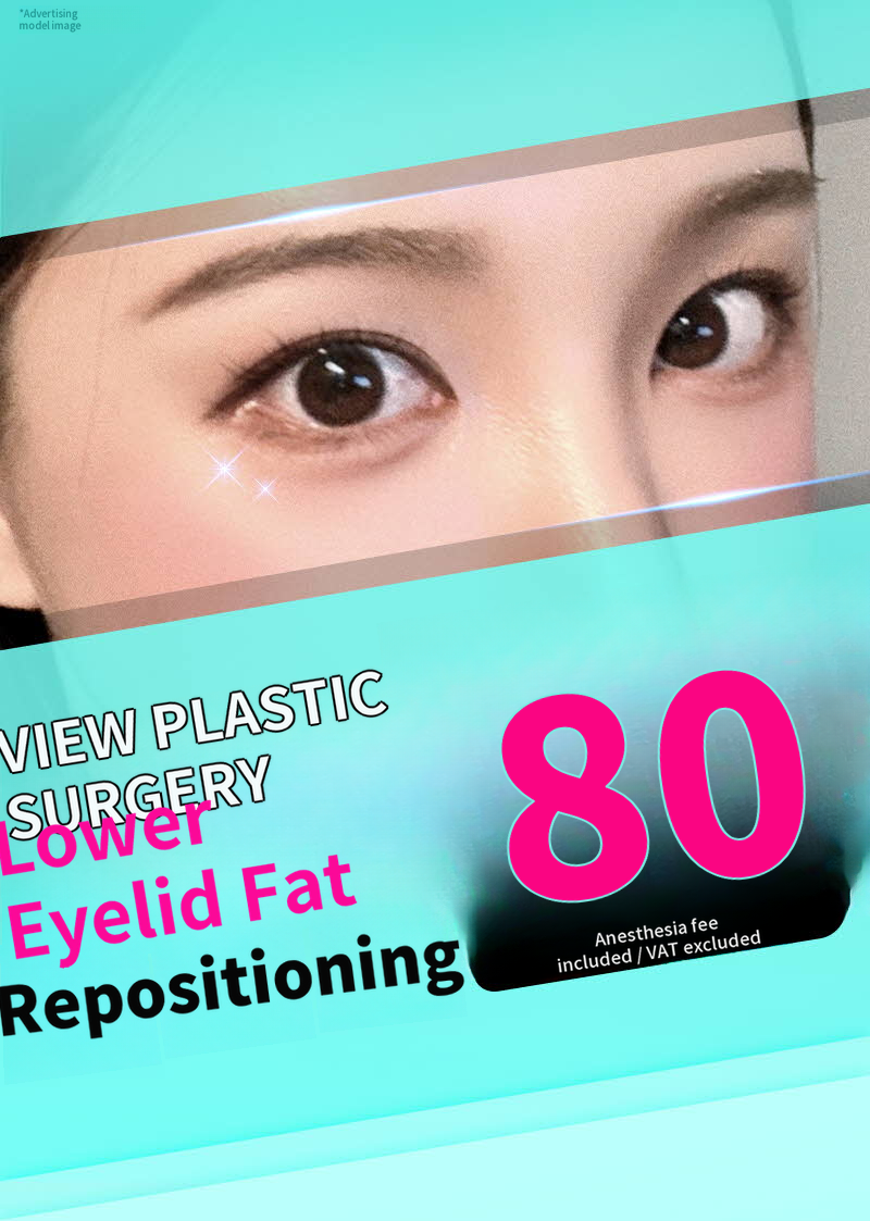 ❤️View❤️Under-Eye Fat Repositioning