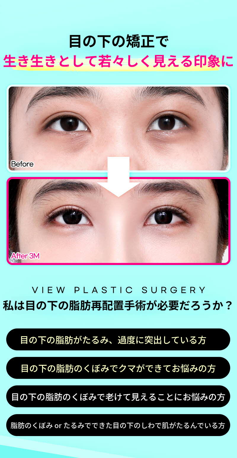 ❤️ビュー❤️目の下脂肪再配置