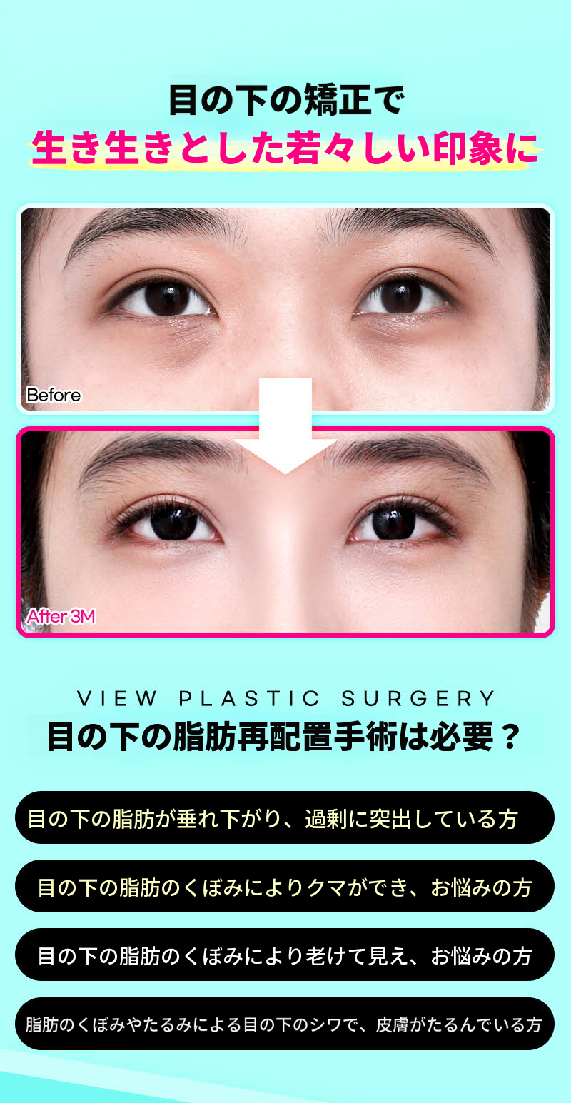 ❤️ビュー❤️目の下の脂肪再配置