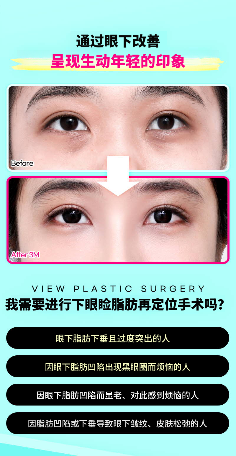 ❤️维❤️眶隔脂肪释放
