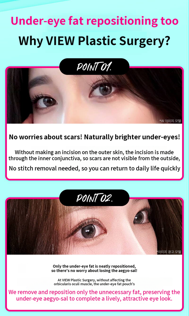 ❤️View❤️Lower Eyelid Fat Repositioning