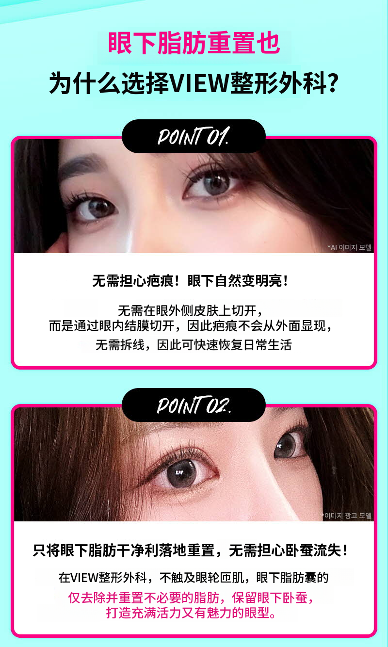 ❤️视线❤️下眼睑脂肪重塑