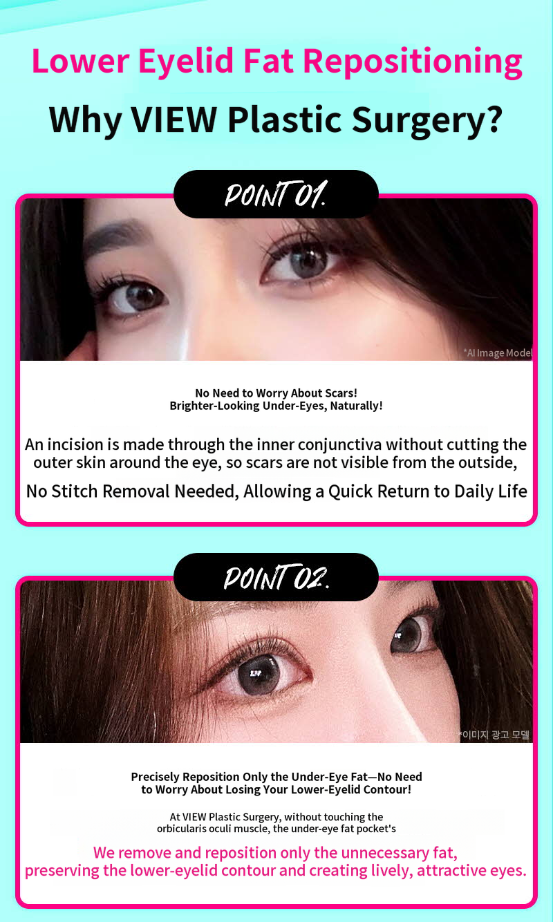 ❤️View❤️Under-Eye Fat Repositioning