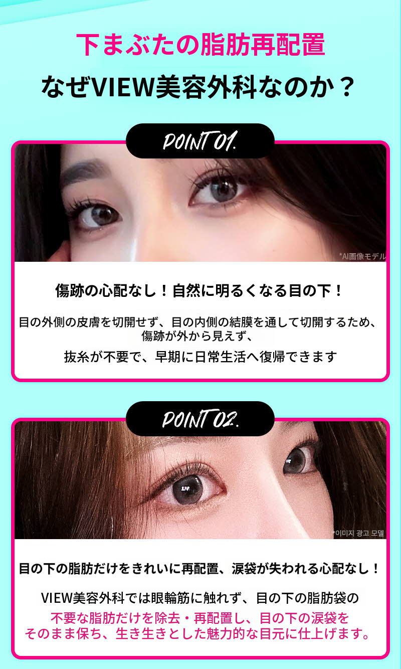 ❤️ビュー❤️目の下の脂肪再配置