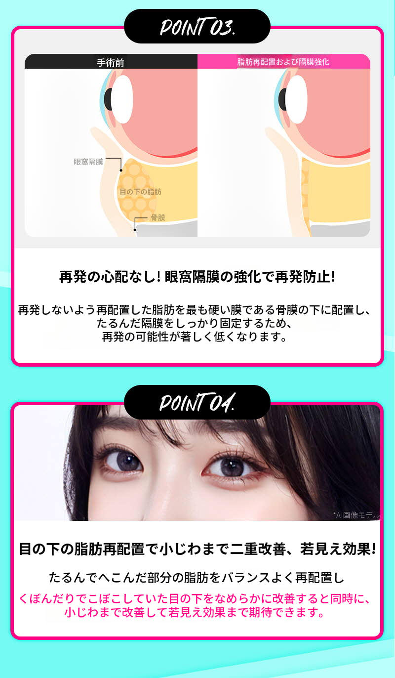 ❤️ビュー❤️目の下脂肪再配置
