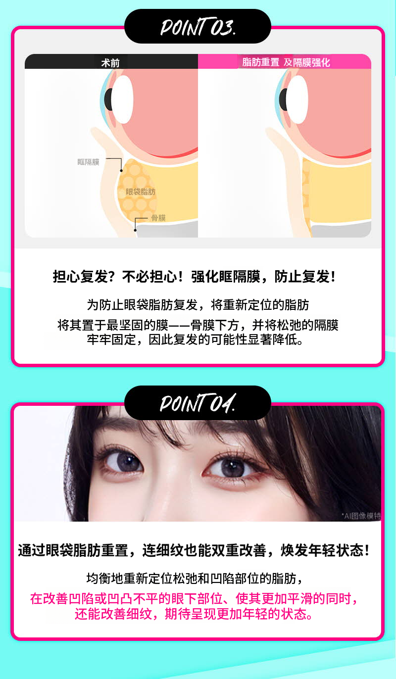 ❤️维❤️眶隔脂肪释放