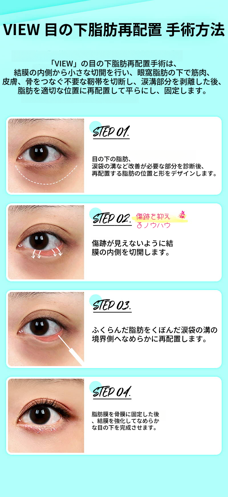 ❤️ビュー❤️目の下脂肪再配置
