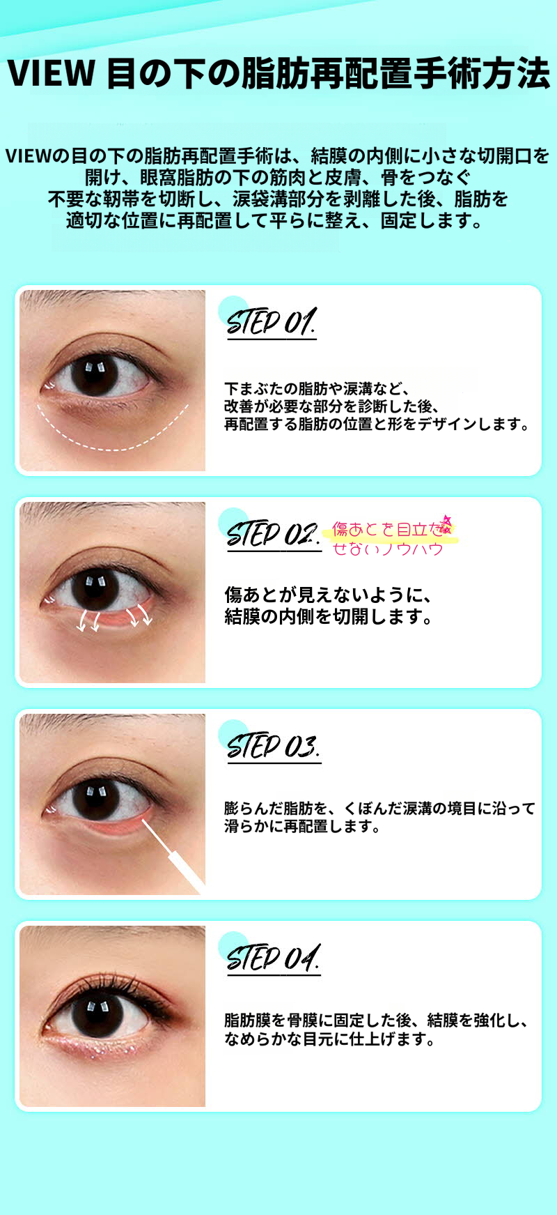 ❤️ビュー❤️目の下の脂肪再配置