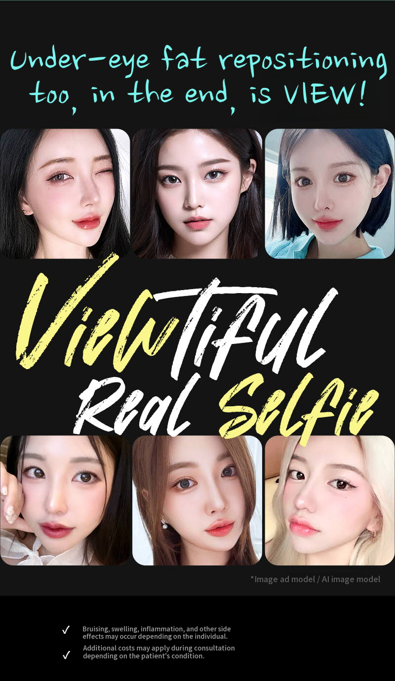 ❤️View❤️Lower Eyelid Fat Repositioning