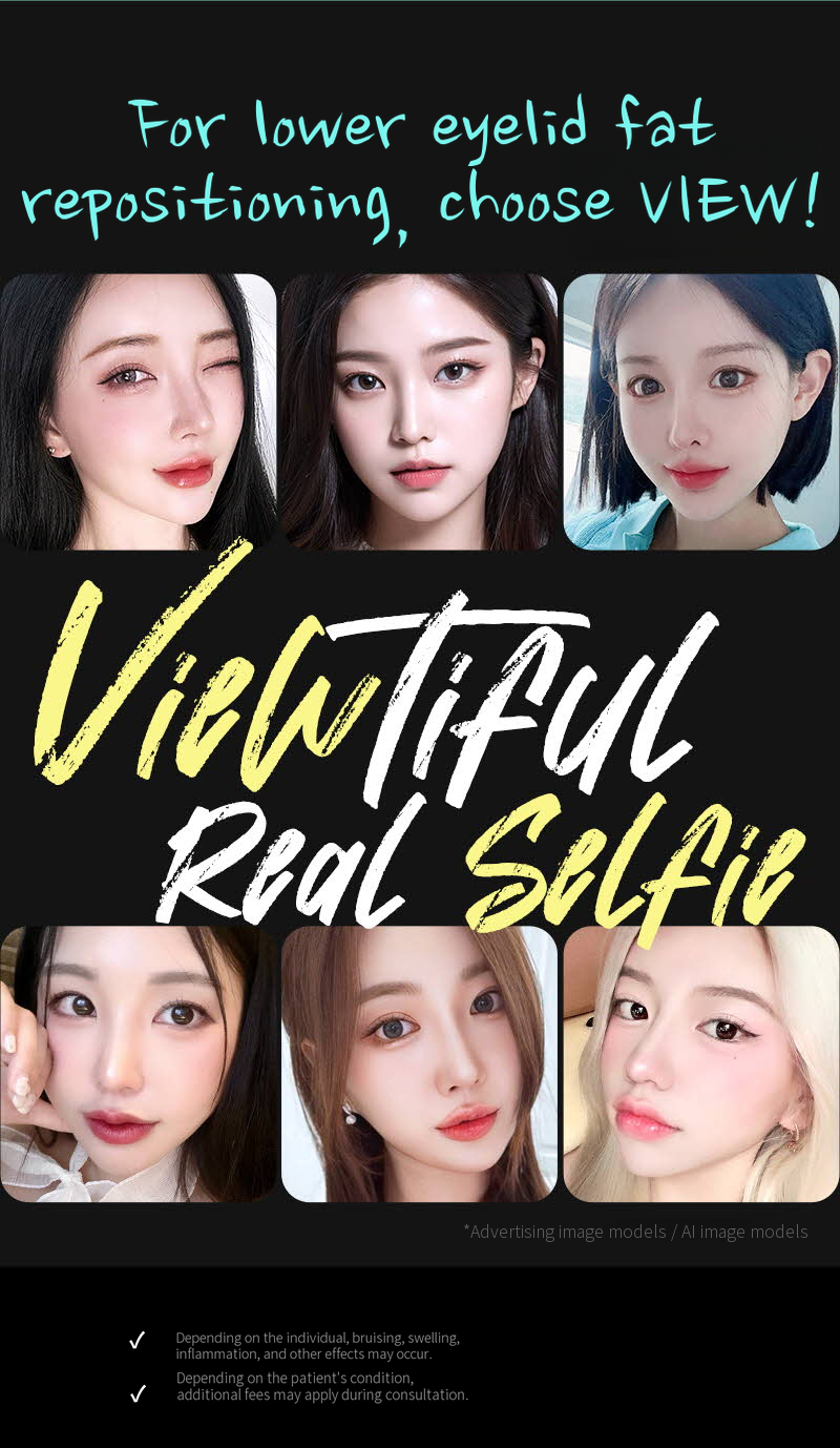 ❤️View❤️Under-Eye Fat Repositioning