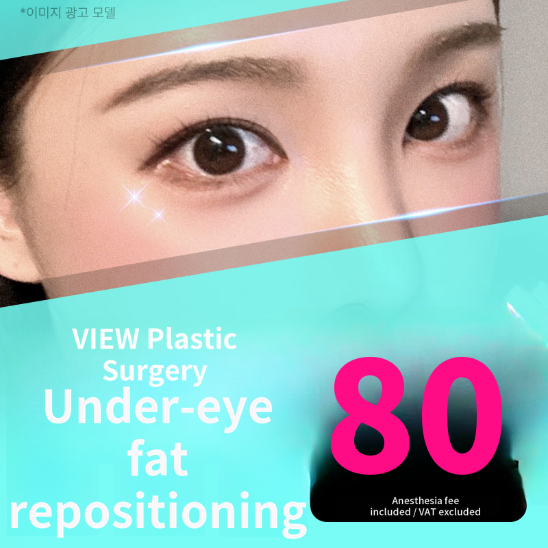 ❤️View❤️Lower Eyelid Fat Repositioning
