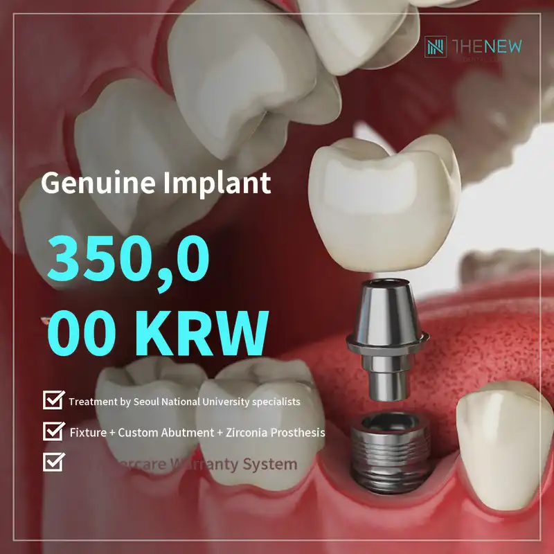 Implants from Seoul National University, 350,000 KRW