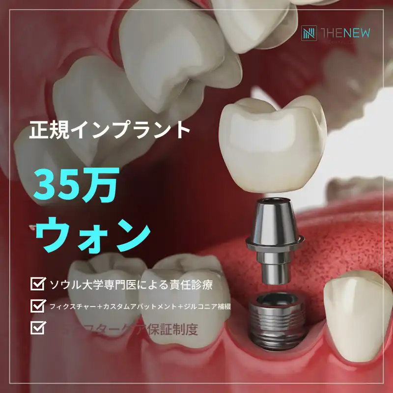 全員がソウル大学出身インプラント35万円