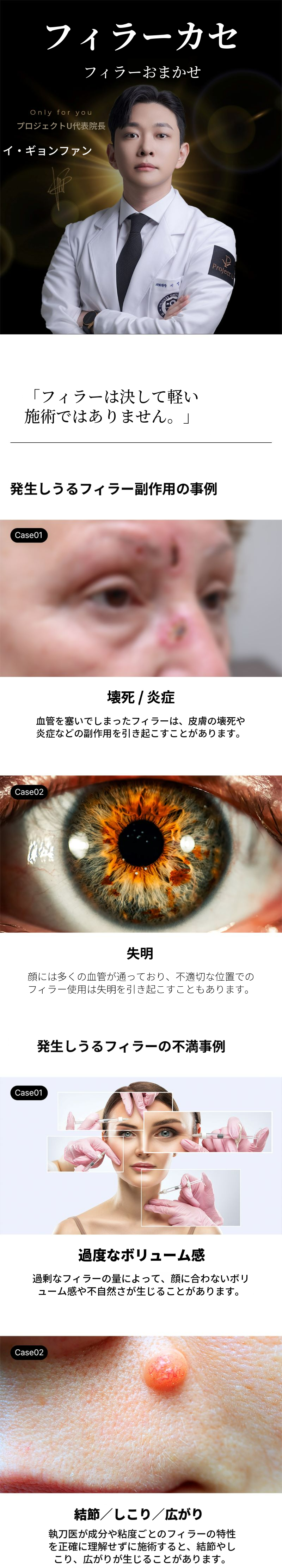 💎フィラーカセ💎代表院長による直接施術