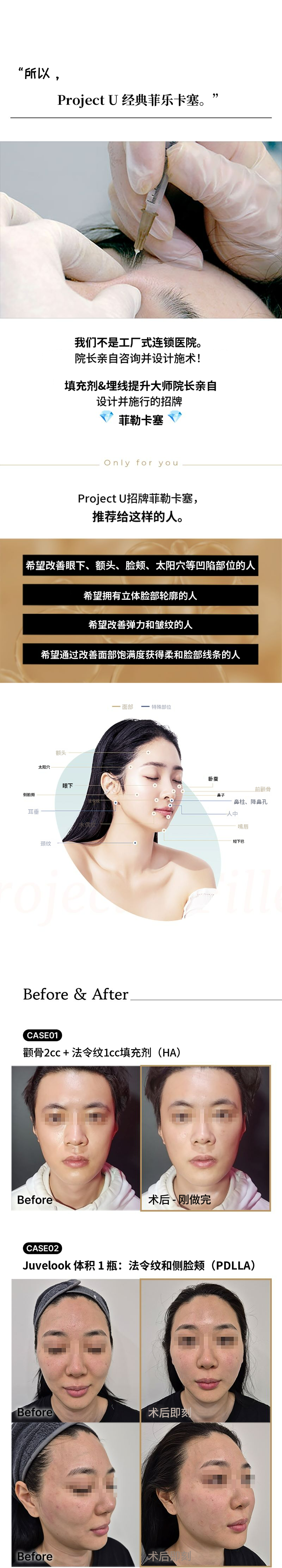 💎注射剂💎主治医生直接施术