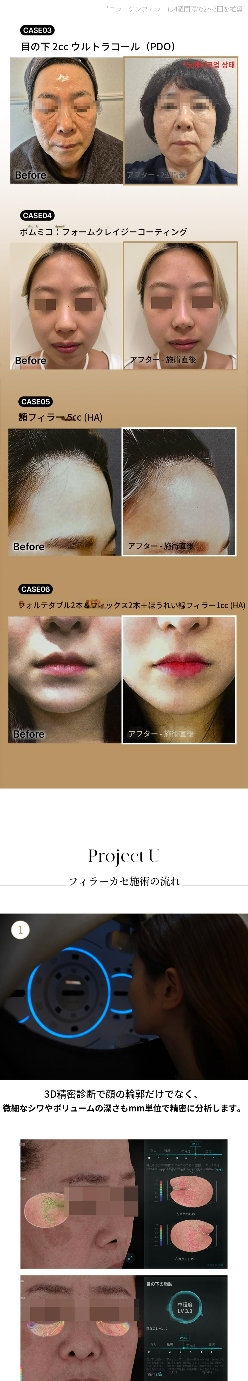 💎フィラーカセ💎代表院長による直接施術