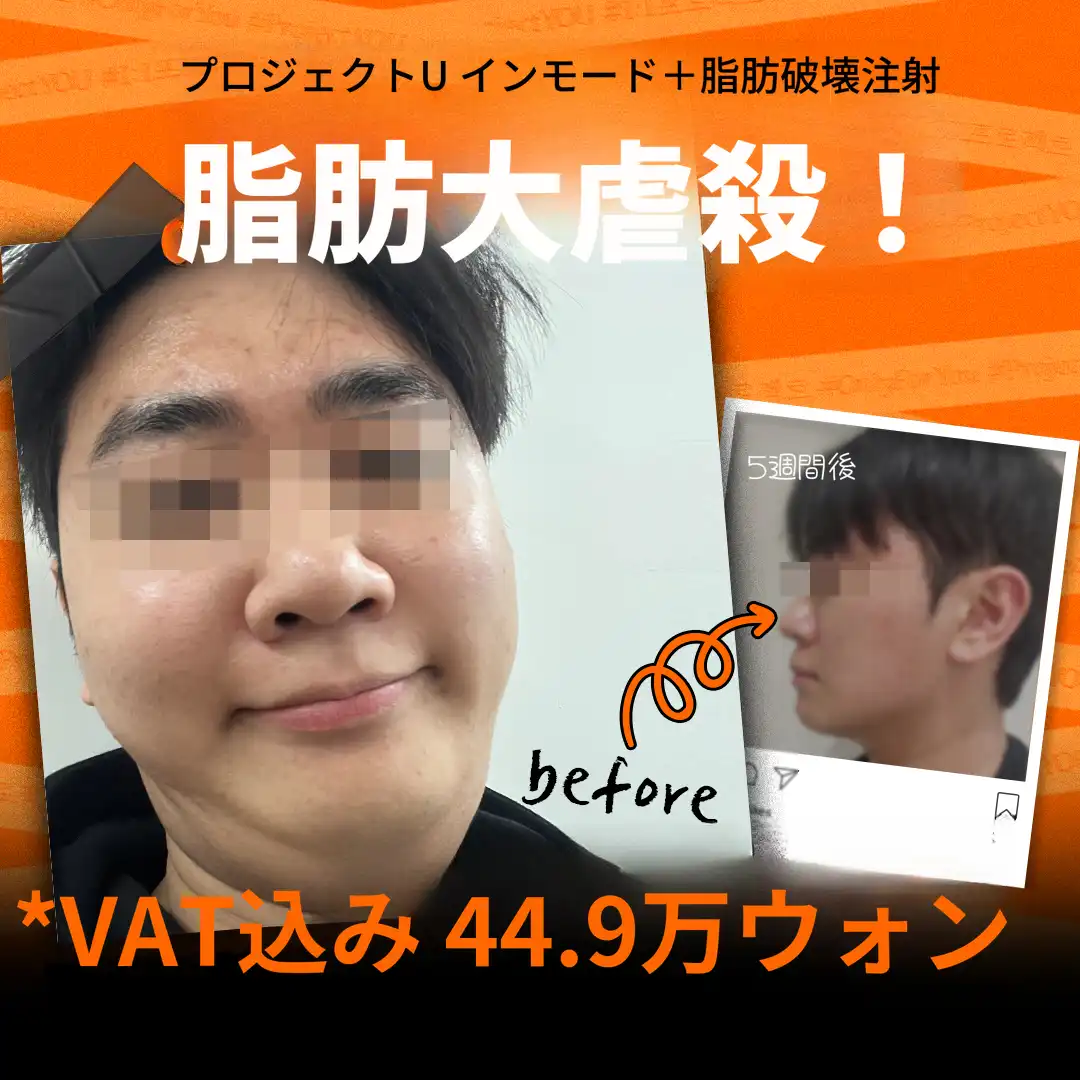 🫠シグネチャー脂肪破壊⏰時間保証⏰💉