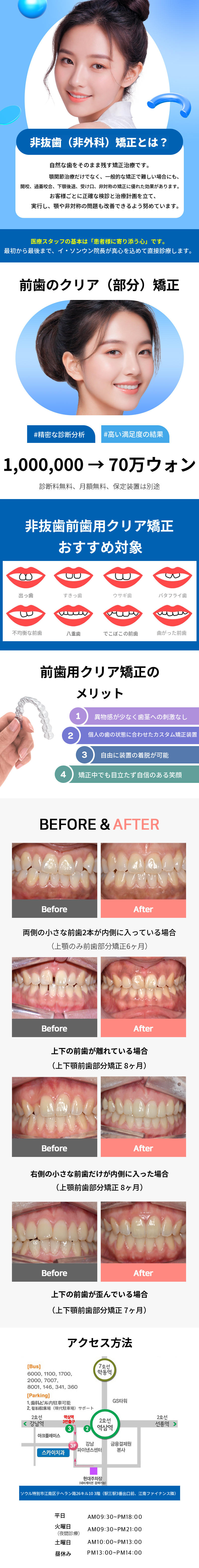[特価] 前歯透明(部分)矯正