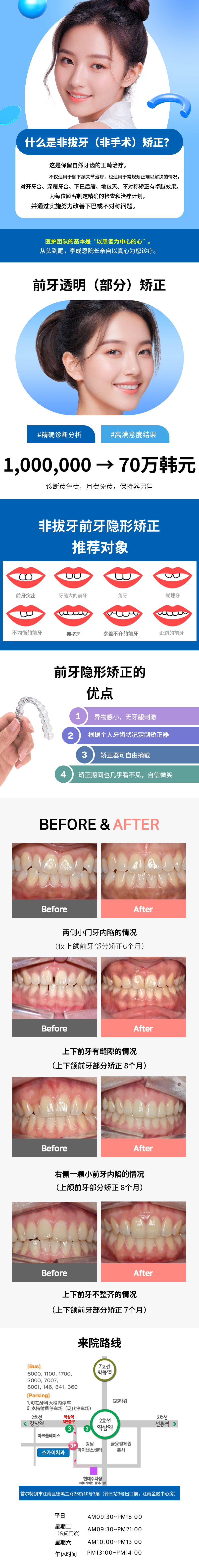 [特价] 前牙透明（局部）矫正
